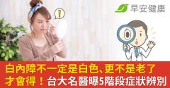 白內障不一定是白色、更不是老了才會得！台大名醫曝5階段症狀辨別