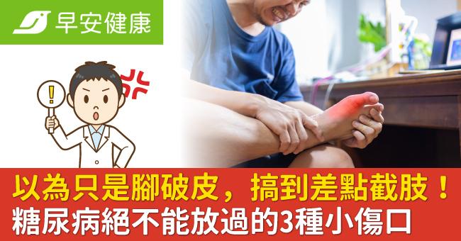 以為只是腳破皮,搞到差點截肢!糖尿病絕不能放過的3種小傷口