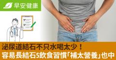 泌尿道結石不只水喝太少！容易長結石5飲食習慣「補太營養」也中