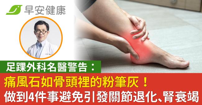 痛風石如骨頭裡的粉筆灰！做到4件事避免引發關節退化、腎衰竭