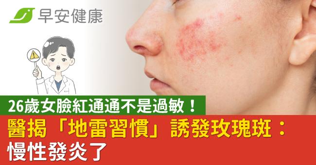 26歲女臉紅通通不是過敏！醫揭「地雷習慣」誘發玫瑰斑：慢性發炎了
