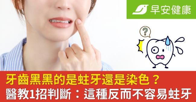 牙齒黑黑的是蛀牙還是染色？醫教1招判斷：這種反而不容易蛀牙