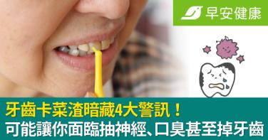 牙齒卡菜渣暗藏4大警訊！可能讓你面臨抽神經、口臭甚至掉牙齒