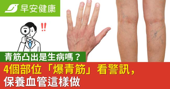 青筋凸出是生病嗎?4個部位「爆青筋」看警訊,保養血管這樣做