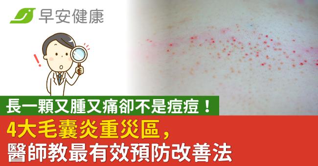 長一顆又腫又痛卻不是痘痘!4大毛囊炎重災區,醫師教最有效預防改善法
