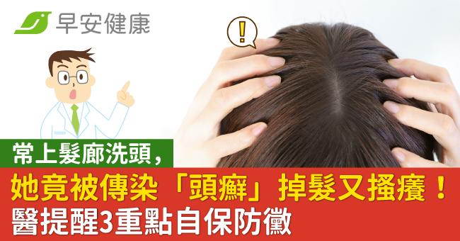 常上髮廊洗頭,她竟被傳染「頭癬」掉髮又搔癢!醫提醒3重點自保防黴
